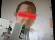 Dugaan Pelecehan di Klinik Pratama Unri, Terduga Pelaku Dinonaktifkan Sementara